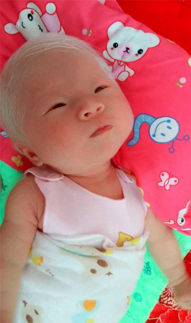 sinh con da trang nhu "trung ga boc", me dau long khi phat hien ra su that - 2