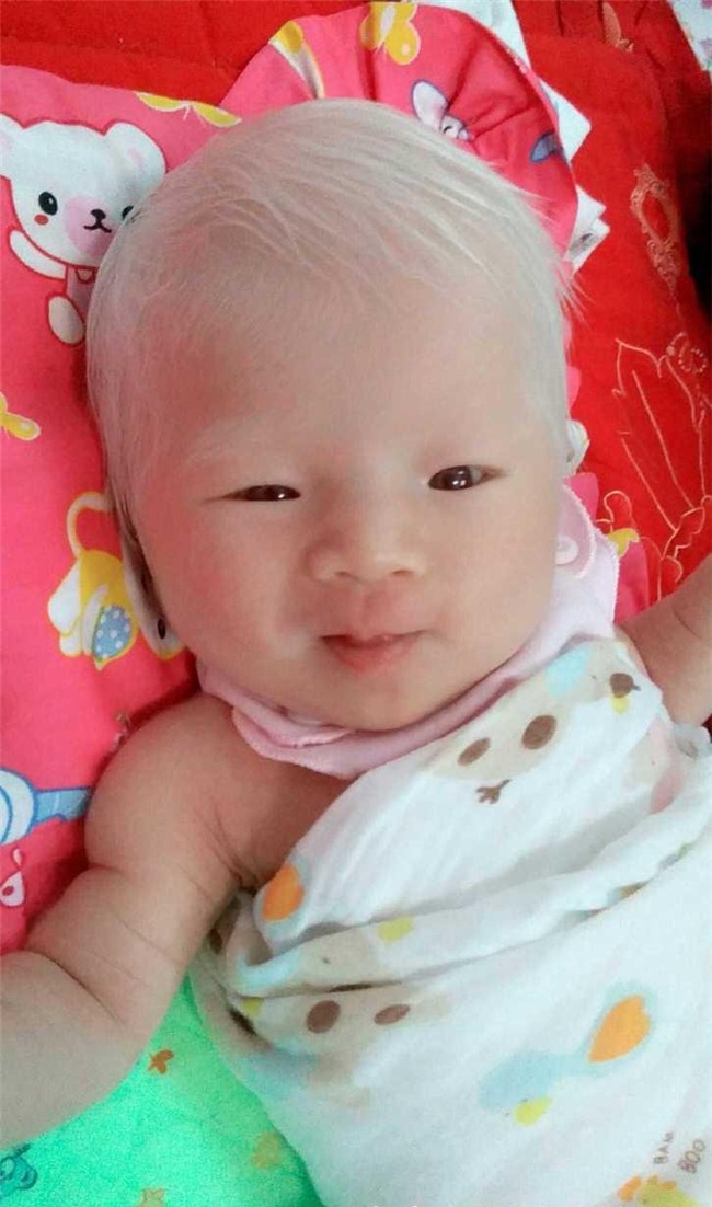 sinh con da trang nhu "trung ga boc", me dau long khi phat hien ra su that - 3