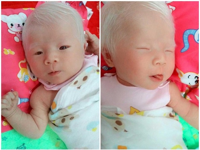 sinh con da trang nhu "trung ga boc", me dau long khi phat hien ra su that - 5