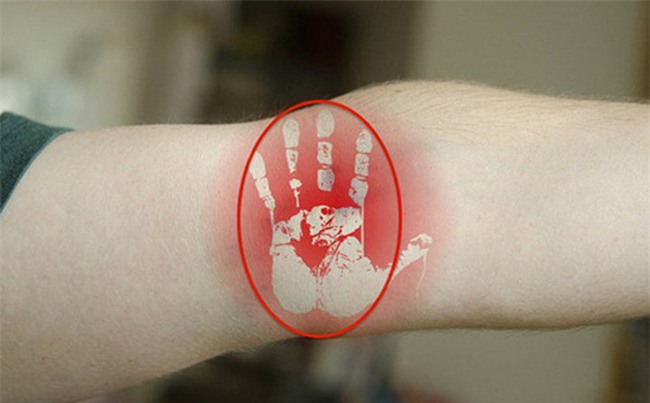 Trên cơ thể có 3 điểm tập trung độc tố: Trung y chỉ cách làm hàng ngày loại bỏ chất độc