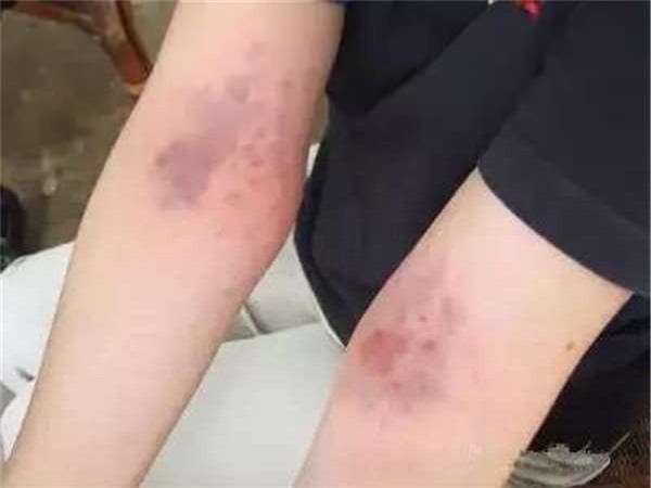 Trên cơ thể có 3 điểm tập trung độc tố: Trung y chỉ cách làm hàng ngày loại bỏ chất độc - Ảnh 2.