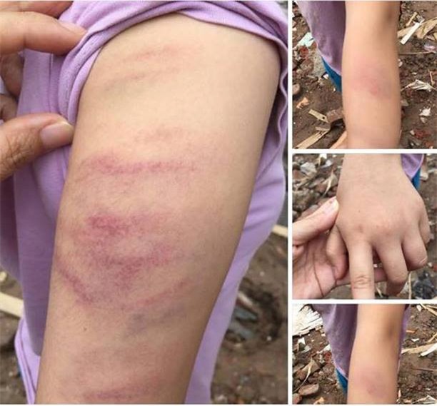 Tam dinh chi co giao danh tim tay hoc sinh vi khong lam du bai tap hinh anh 1