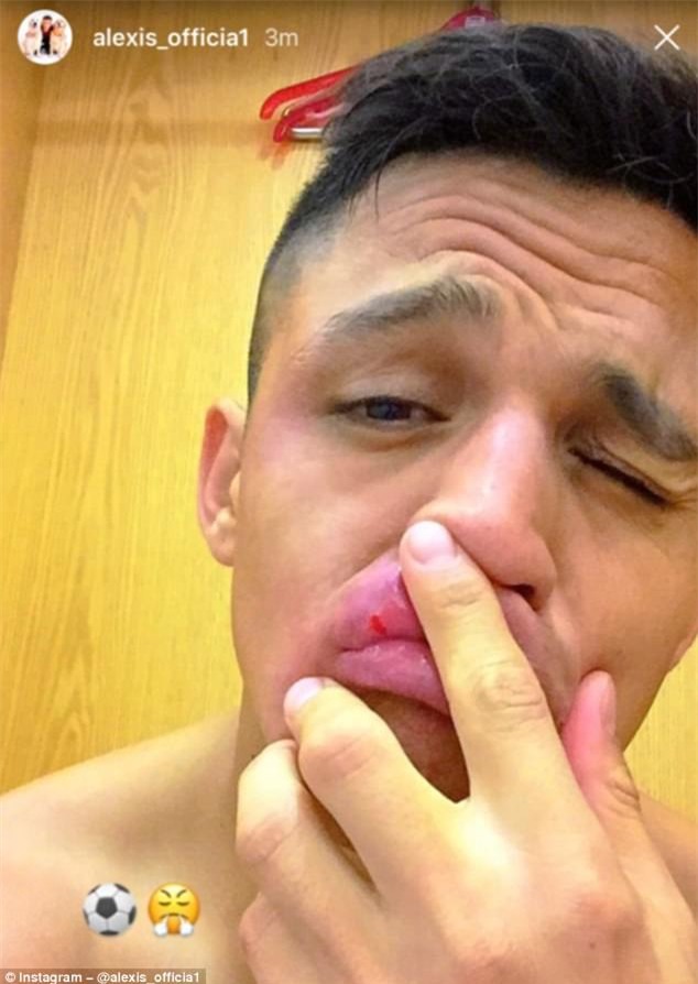 Alexis Sanchez tái hiện pha ăn vạ thô thiển của huyền thoại Brazil - Ảnh 4.