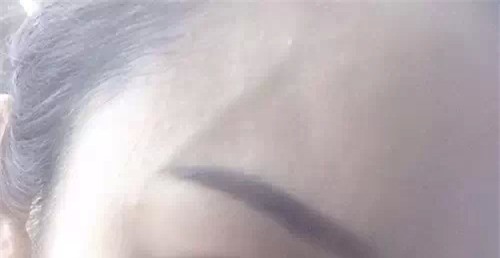 Phụ nữ chớ nên coi thường việc nổi gân xanh trên cơ thể, nhất là trên chân - Ảnh 2.