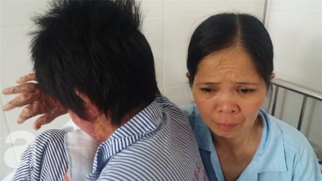 Nỗi đau và ký ức kinh hoàng của người vợ sống sót sau khi bị chồng nhốt rồi tẩm xăng cùng tự thiêu - Ảnh 1.