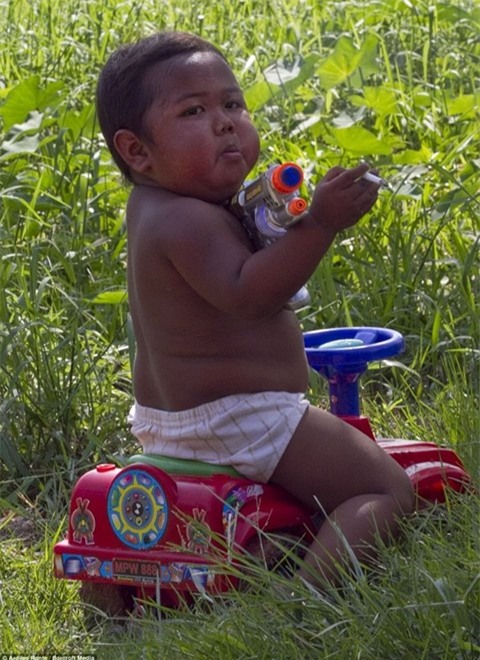 Cậu bé 2 tuổi từng hút 40 điếu thuốc lá/ngày giờ ra sao? - Ảnh 2.