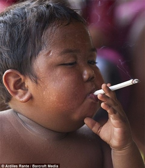 Cậu bé 2 tuổi từng hút 40 điếu thuốc lá/ngày giờ ra sao? - Ảnh 5.