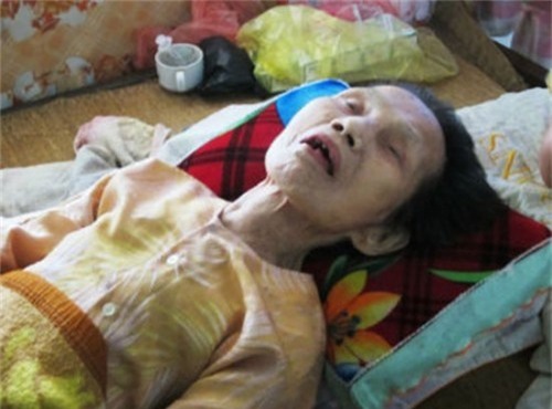 ly ky chuyen nguoi chet song lai khien bac si cung phai kinh ngac - 2