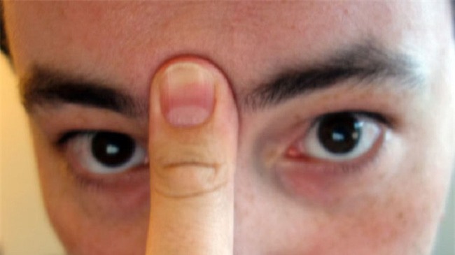 Giảm đau bằng những biện pháp cực đơn giản không cần trợ giúp của bất cứ phương thuốc nào - Ảnh 3.