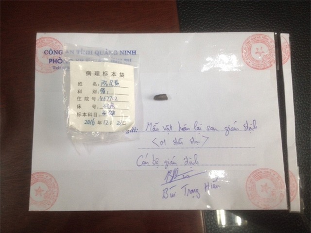 Một trong những đầu đạn công an thu giữ được tại hiện trường vụ án (ảnh Công an cung cấp)