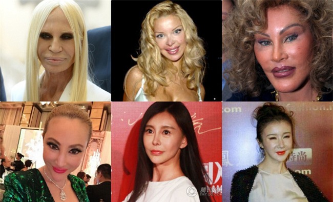 Showbiz Việt thời đập mặt xây lại dễ dàng như tiêm một liều thuốc kháng sinh - Ảnh 3.