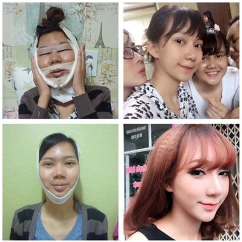Cô gái xinh đẹp bán trà đá trước cổng trường ĐH lại gây sốt khi công khai chuyện đập mặt đi sửa lại và nâng ngực - Ảnh 4.