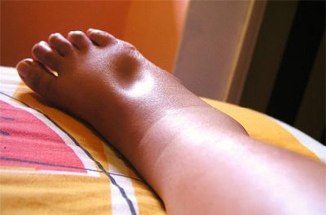 Khi cơ thể có những dấu hiệu này, hãy đi khám thận càng sớm càng tốt - Ảnh 2.