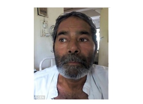  Ông Meena cùng gia đình không hề biết tại sao trong người ông lại có nhiều cây kim như vậy. Ảnh: DAILY MAIL