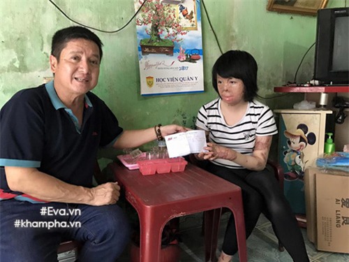 nghi luc phi thuong cua co gai 9x chi con 1% co hoi song do bi chong thieu xang - 2