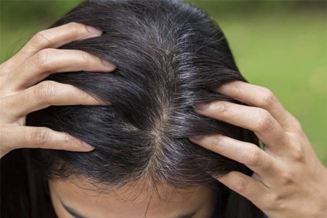 Đừng xem nhẹ, tóc bạc sớm cũng là dấu hiệu cảnh báo hàng loạt vấn đề sức khỏe - Ảnh 2.