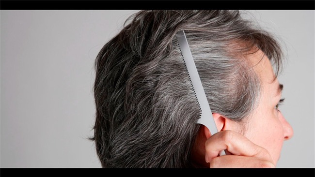 Đừng xem nhẹ, tóc bạc sớm cũng là dấu hiệu cảnh báo hàng loạt vấn đề sức khỏe - Ảnh 3.
