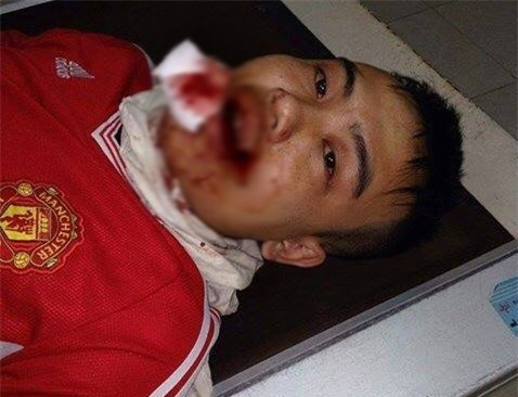 Chồng chị Phương bị hành hung phải nhập viện cấp cứu.