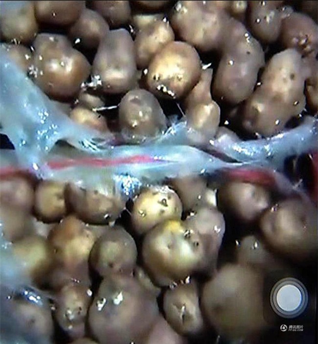 Cha mẹ bức xúc tố nhà bếp trường tiểu học dùng khoai tây mọc mầm và thịt gà mốc - Ảnh 1.