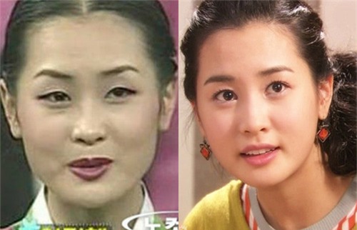 nhung my nhan chau a tung kem sac bong “doi doi” nho phau thuat tham my - 6