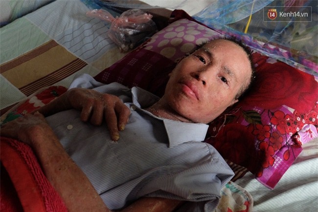 Cuộc sống khốn khó của người chồng liệt giường suốt 2 năm, từng muốn chết để vợ con bớt khổ - Ảnh 10.