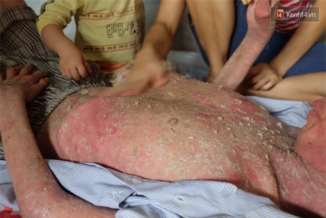 Cuộc sống khốn khó của người chồng liệt giường suốt 2 năm, từng muốn chết để vợ con bớt khổ - Ảnh 3.