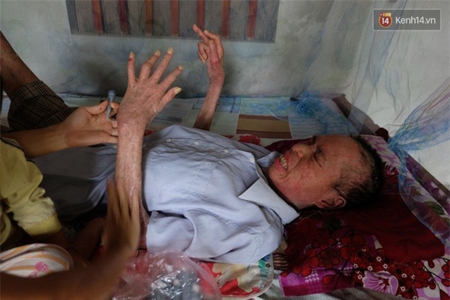Cuộc sống khốn khó của người chồng liệt giường suốt 2 năm, từng muốn chết để vợ con bớt khổ - Ảnh 9.