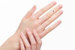 ban-tay-co-not-ruoi1 phunutoday