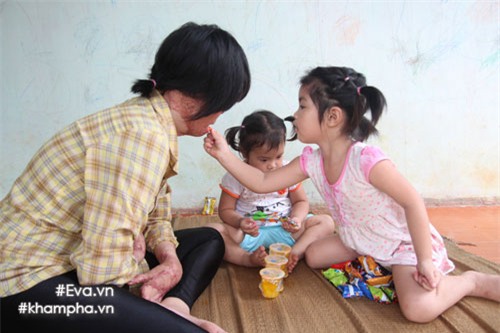 co gai xinh dep bi chong dung xang thieu: “chong muon toi tiep tuc song chung khi ra tu” - 1