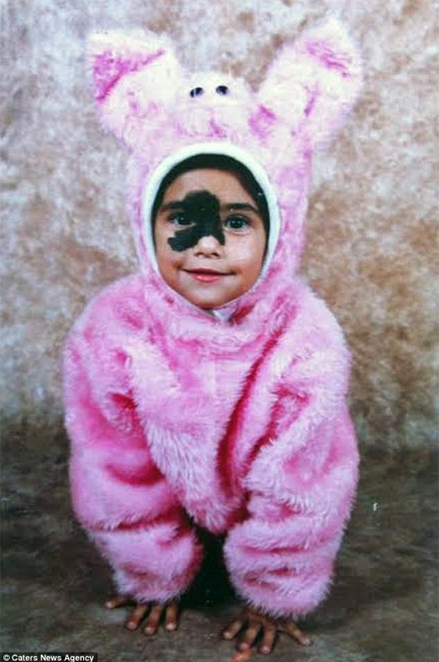 Sinh ra đã có vết bớt sậm màu trên mặt, 24 năm sau, cô gái thực sự tỏa sáng với vẻ đẹp lạ của mình - Ảnh 2.