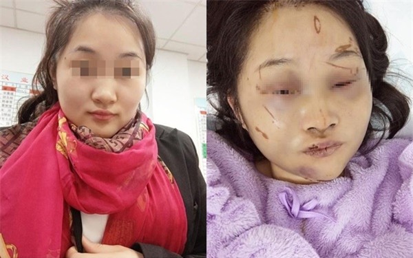 Yêu người đàn ông hơn 20 tuổi qua mạng, thiếu nữ xinh đẹp nhận kết cục bi đát sau 3 tháng hẹn hò - Ảnh 1.