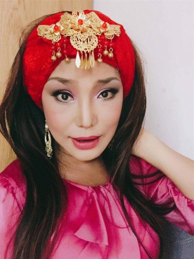 Cindy Thái Tài tiếp tục sửa mũi lần 5, đập đi xây lại toàn bộ mặt - Ảnh 4.