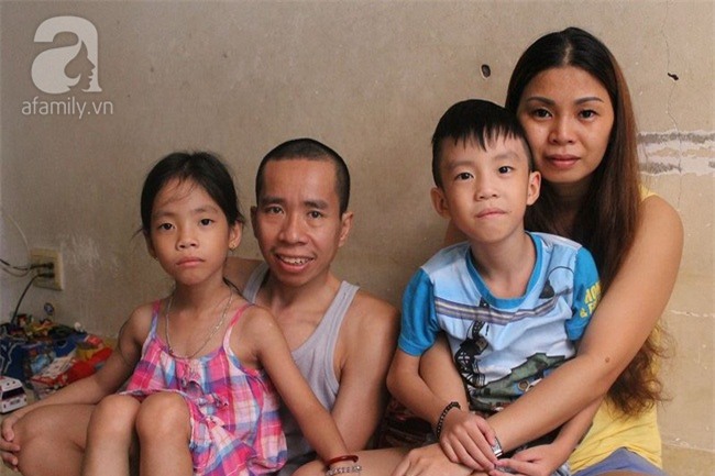 Người em trong cặp song sinh Việt - Đức phải phẫu thuật tạo hình niệu quản - Ảnh 3.