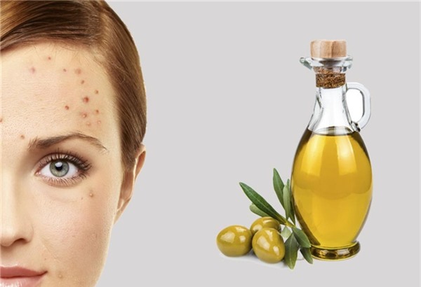 Nhung thu than ki boi len mat sau khi nan mun se khong de lai vet tham