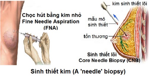 Phát hiện sớm ung thư cần làm các xét nghiệm nào? - Ảnh 1.