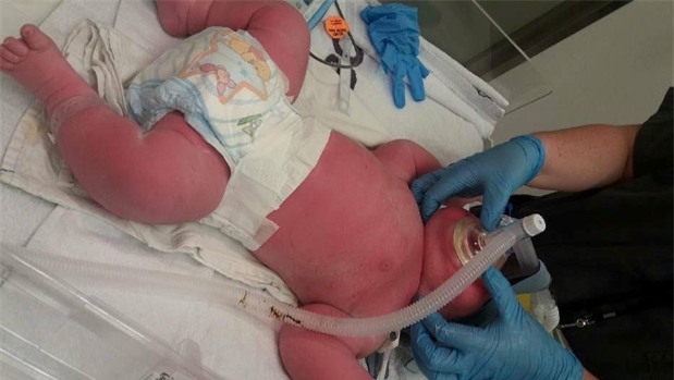 Dù đã dự đoán trước nhưng bác sĩ và bố mẹ đều sốc khi em bé này chào đời - Ảnh 1.