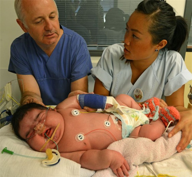 Dù đã dự đoán trước nhưng bác sĩ và bố mẹ đều sốc khi em bé này chào đời - Ảnh 2.
