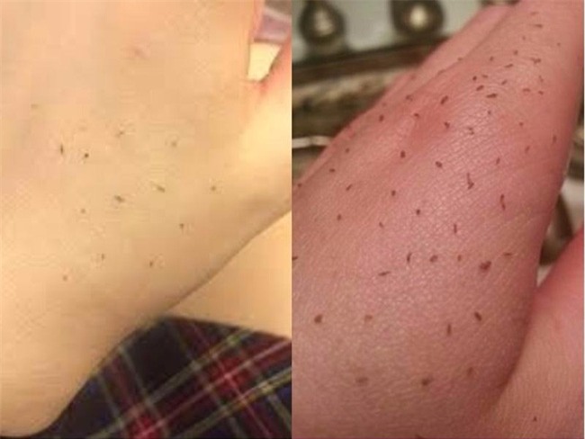 Thử ngay hôm nay: Cách hút nhờn thần kỳ và đẩy mụn đầu đen tự chui ra khỏi da mà không cần nặn - Ảnh 1.