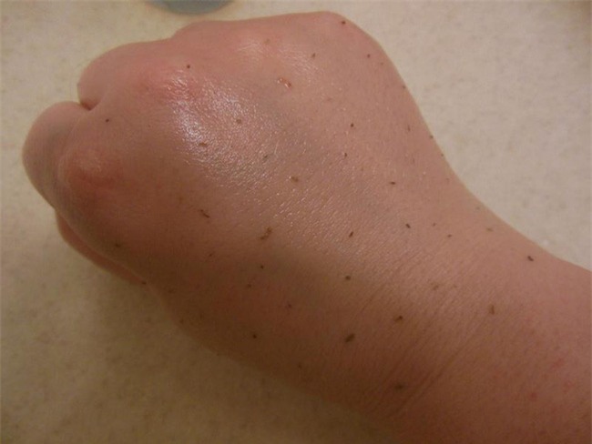 Thử ngay hôm nay: Cách hút nhờn thần kỳ và đẩy mụn đầu đen tự chui ra khỏi da mà không cần nặn - Ảnh 2.