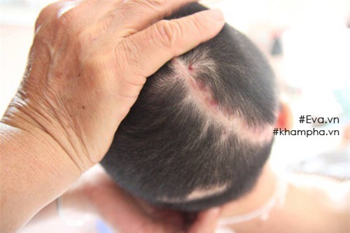 sau mot nam, nguoi me tre trong vu no bom o ha dong chi biet khoc moi khi con vao tham - 6