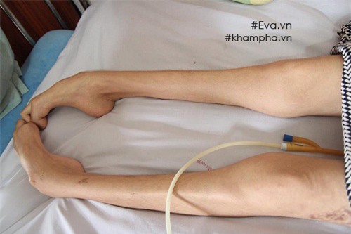 sau mot nam, nguoi me tre trong vu no bom o ha dong chi biet khoc moi khi con vao tham - 8