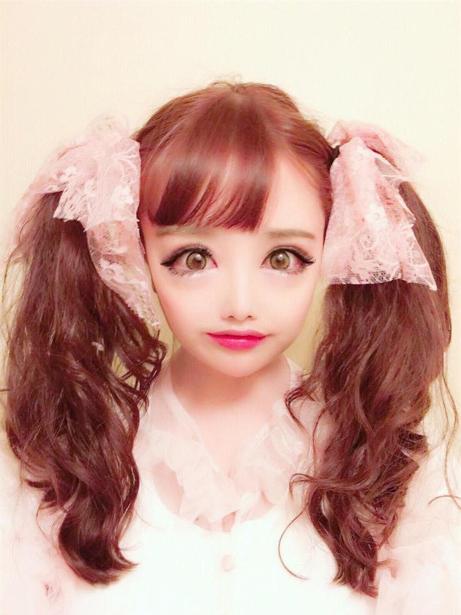 7 ca phẫu thuật thẩm mỹ kỳ lạ và quái đản nhất thế giới - Ảnh 3.