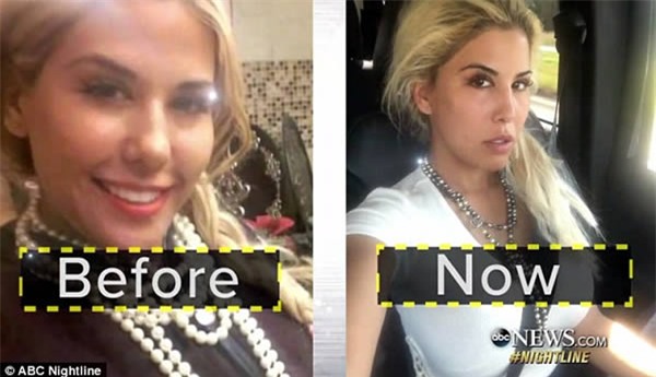 7 ca phẫu thuật thẩm mỹ kỳ lạ và quái đản nhất thế giới - Ảnh 5.