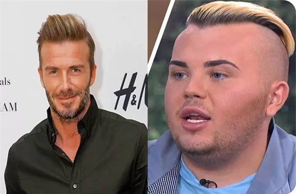 7 ca phẫu thuật thẩm mỹ kỳ lạ và quái đản nhất thế giới - Ảnh 6.