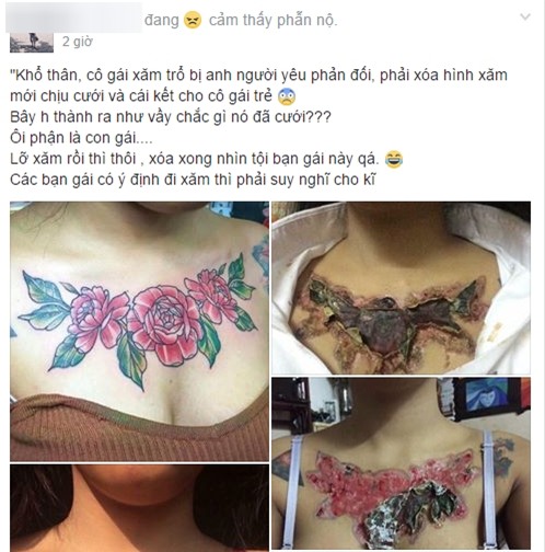 Sự thật câu chuyện cô gái xăm hình nhận hậu quả kinh hoàng sau khi người yêu bắt xóa xăm mới chịu cưới - Ảnh 1.