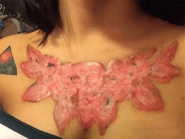 Sự thật đằng sau câu chuyện cô gái nhận cái kết đắng, khi nghe lời người yêu bảo muốn cưới phải xóa xăm. - Ảnh 10.