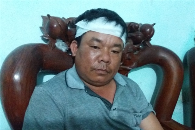 Anh Sỉnh là người đầu tiên có mặt tại hiện trường cứu 3 anh em ruột bị rơi xuống hố biogas. Ảnh: Đ.Tuỳ