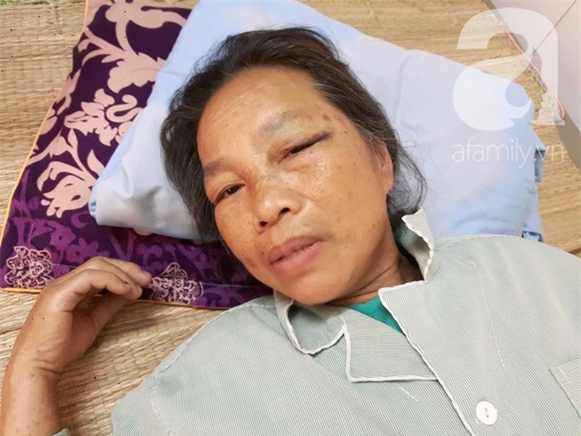 Hà Nội: Bà lão gần 70 tuổi bị em trai dùng xẻng tấn công khiến nhập viện cấp cứu - Ảnh 2.