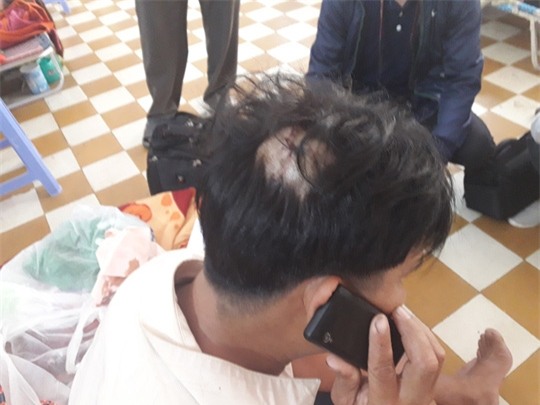 Tranh giành khách, con trai cán bộ y tế liên tục truy sát người - 2