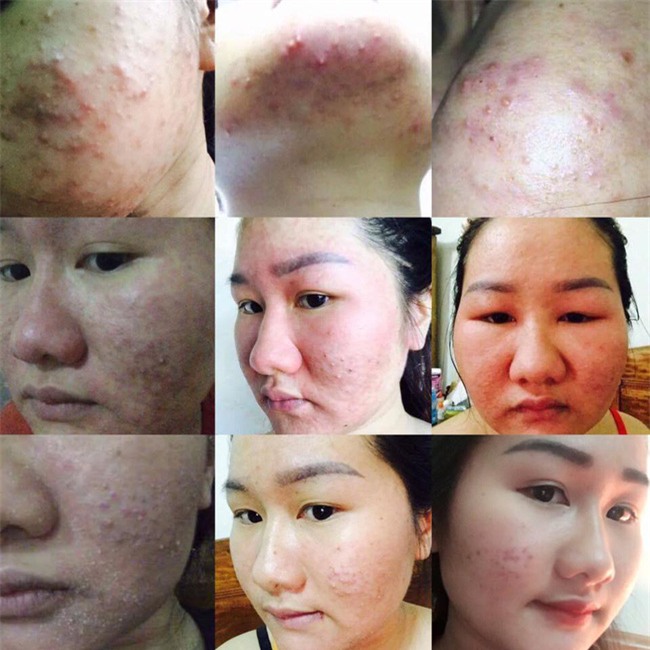 Tăng 30kg và xấu như Thị Nở khi mang thai, mẹ 9X đã lột xác ngoạn mục nhờ những bí quyết này - Ảnh 6.